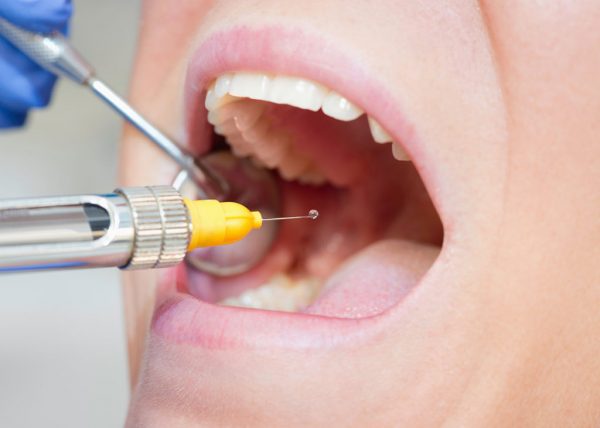 Все про анестезию в стоматологии